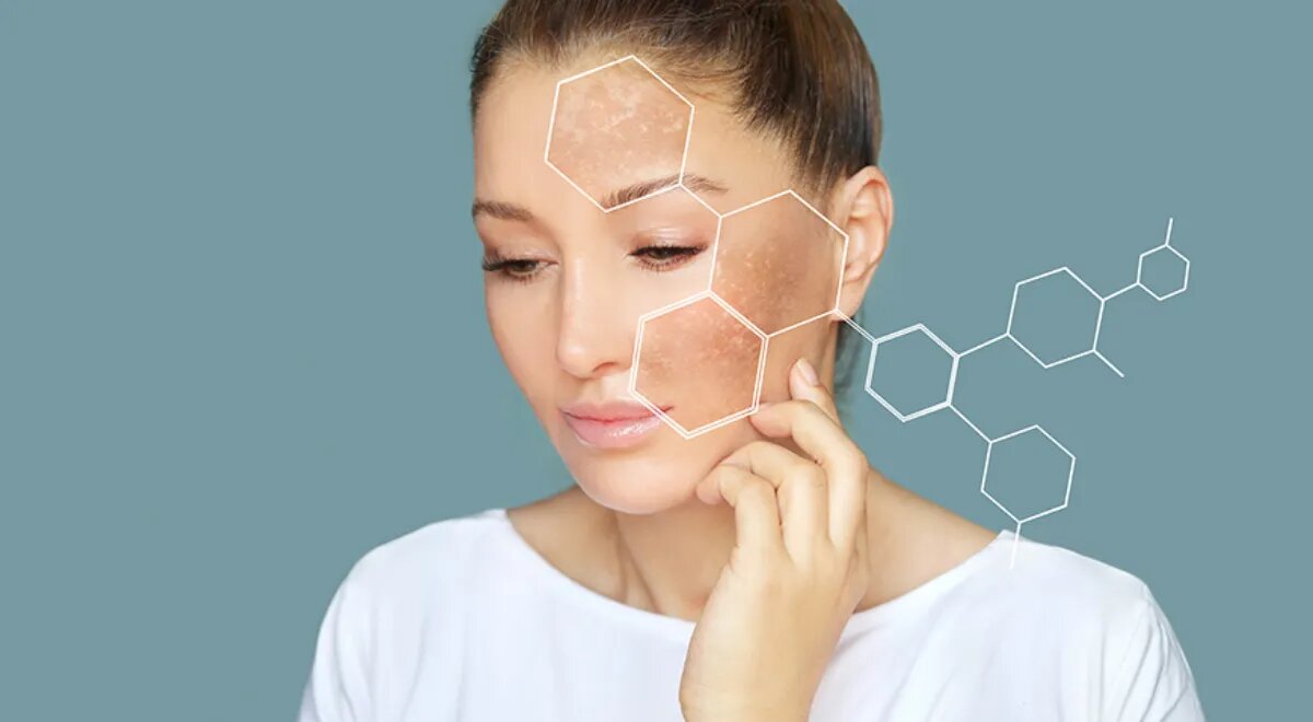 Как продукты питания помогают избавиться от пигментных пятен